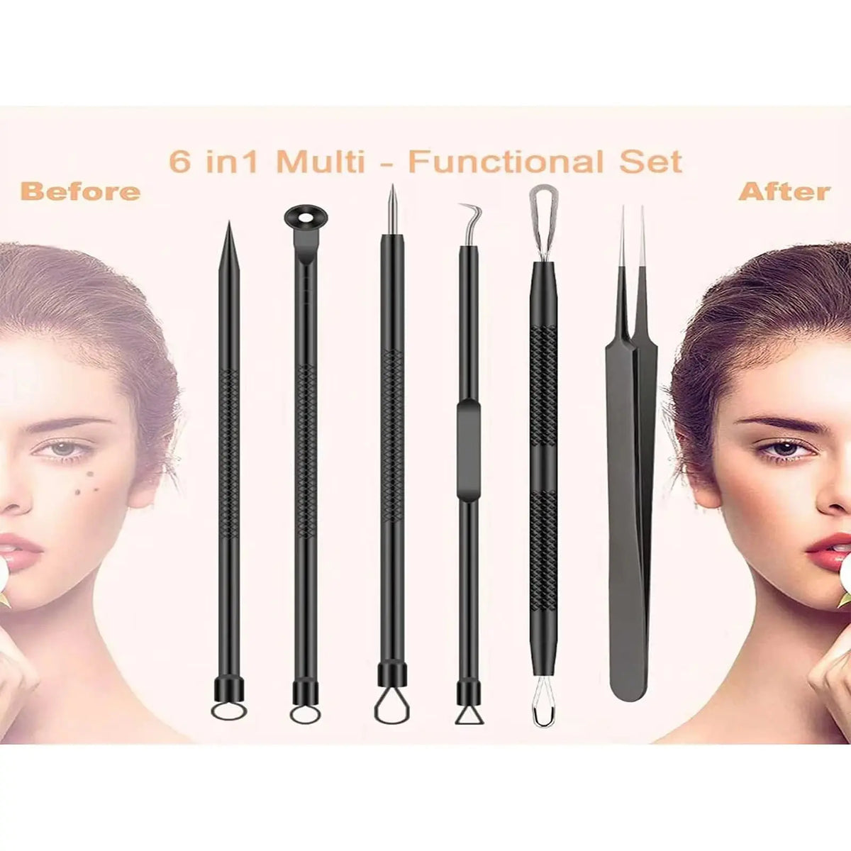 6-piece stainless steel blackhead remover tool set