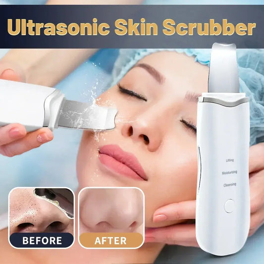 rechargeable ultrasonic facial skin scrubber