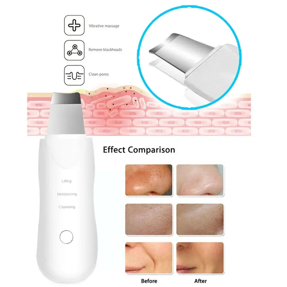 rechargeable ultrasonic facial skin scrubber