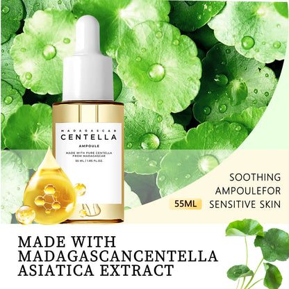 Centella Asiatica Brightening Serum: Calms Irritation, Reduces Breakouts, Balances Sebum & Diminishes Dark Marks for Clear Skin.