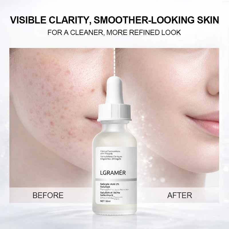 Salicylic Acid 2% Facial Essence, Acne-Fighting Serum for Blemish-Prone,Deep Moisturizing Skin,The Skin Facial Skin Essence New